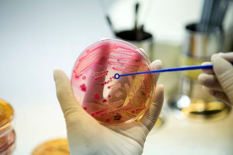 How to Manage Myopia: Eye Care Tips, Treatment Options, and Vision Health Strategies