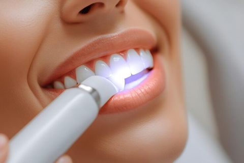 Teeth Whitening Insights: Methods, Treatment Options, Safety Factors and Aftercare Tips