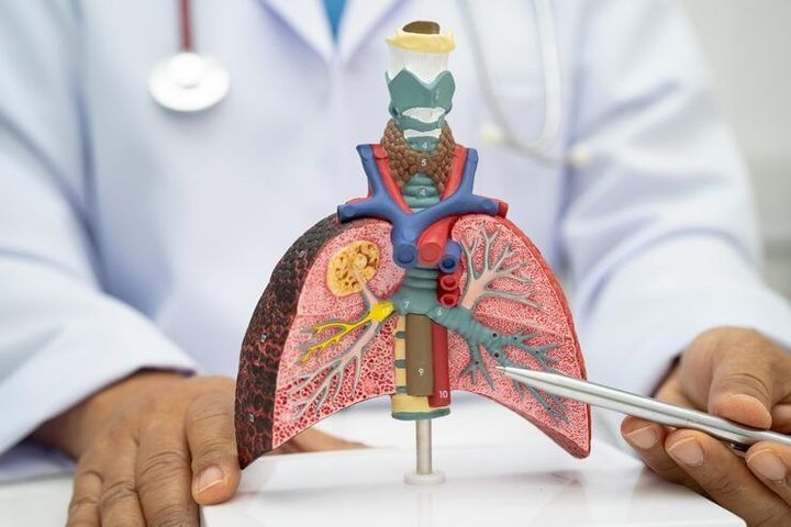 Lung Cancer Treatment Guide: Medical Approaches, Treatment Stages and Recovery Factors