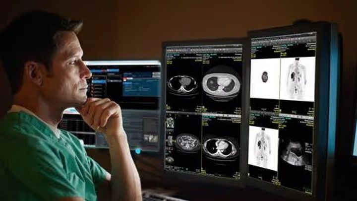 Guide to PACS Tools: Features, Benefits & Implementation Insights