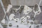 3D Printed Medical Implants Guide: Designs, Materials, Uses, Benefits and Manufacturing Methods